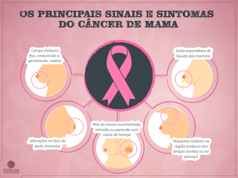 Câncer de mama: a prevenção ainda é a melhor solução. Imagem: FENAM